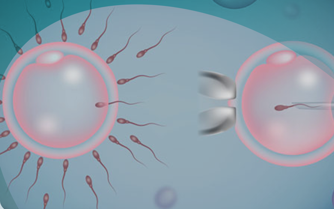 Qual da diferença entre FIV e ICSI?