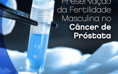 Câncer de próstata – preservação da fertilidade masculina