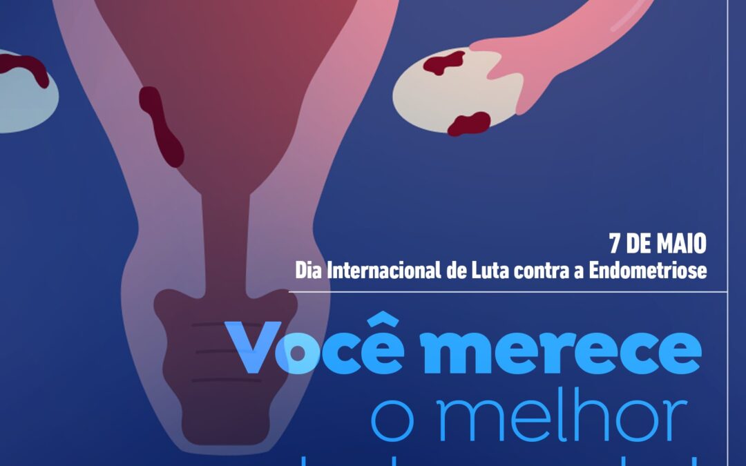 Endometriose – você merece o melhor tratamento