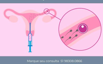 5 motivos para fazer a inseminação artificial