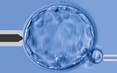 Diagnóstico genético pré–implantacional em Reprodução Assistida – Quando fazer?