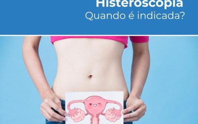 Histeroscopia – quando é indicada?
