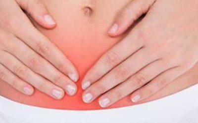 Endometriose – o que é?