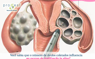 Você sabia que o número de óvulos coletados influencia no sucesso da Fertilização in vitro?